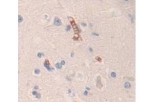 Used in DAB staining on fromalin fixed paraffin- embedded Kidney tissue (Contactin 6 Antikörper  (AA 658-907))