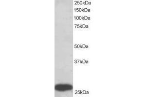 Western Blotting (WB) image for anti-phosphoglycerate Mutase 1 (Brain) (PGAM1) (C-Term) antibody (ABIN2466100) (PGAM1 Antikörper  (C-Term))