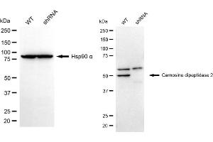 Western blotting analysis using carnosine dipeptidase 2 antibody (ABIN7798103).