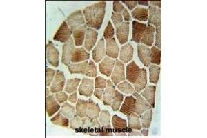 STX7 Antibody (N-term) (ABIN1881855 and ABIN2840425) immunohistochemistry analysis in formalin fixed and paraffin embedded human skeletal muscle followed by peroxidase conjugation of the secondary antibody and DAB staining. (Syntaxin 7 Antikörper  (N-Term))