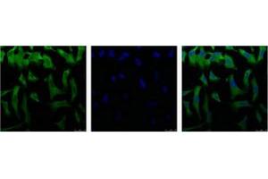 Immunofluorescence staining of HeLa cell line with antibody (Left), DAPI (Middle) and merge (Right). (EIF4A1 Antikörper  (C-Term))