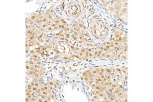 Immunohistochemistry of paraffin-embedded rat ovary using TAZ Rabbit pAb (ABIN6130800, ABIN6150278, ABIN6150279 and ABIN6224227) at dilution of 1:50 (40x lens). (WWTR1 Antikörper  (AA 1-230))