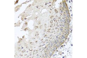 Immunohistochemistry of paraffin-embedded human esophagus using IRS2 antibody (ABIN5974770) at dilution of 1/100 (40x lens).
