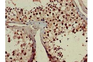 Immunohistochemistry of paraffin-embedded human testis tissue using ABIN7142772 at dilution of 1:100 (RPL23A Antikörper  (AA 1-92))