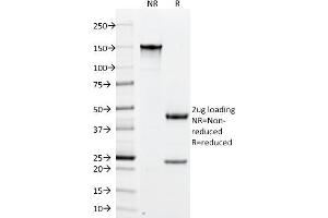 SDS-PAGE Analysis Purified PLGF Monoclonal Antibody (PLGF/94). (PLGF Antikörper)