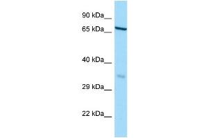 WB Suggested Anti-HAUS3 Antibody Titration: 1. (HAUS3 Antikörper  (N-Term))