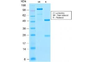 SDS-PAGE Analysis Purified p21 Rabbit Recombinant Monoclonal Antibody (CIP1/2275R). (Rekombinanter p21 Antikörper)