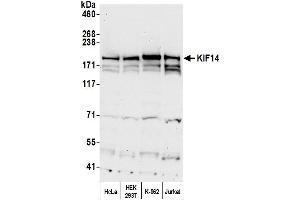 Western Blotting (WB) image for anti-Kinesin Family Member 14 (KIF14) (C-Term) antibody (ABIN7455214) (KIF14 Antikörper  (C-Term))
