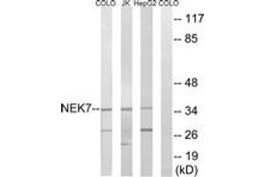 Western blot analysis of extracts from HepG2/Jurkat/COLO cells, using NEK7 Antibody. (NEK7 Antikörper  (AA 101-150))