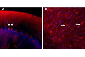 Binding of Stichodactyla Toxin-ATTO Fluor-590 to Purkinje cells in the rat cerebellum.