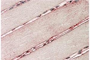 AP32139PU-N Delta-Sarcoglycan staining of paraffin embedded Human Skeletal Muscle at 3. (SGCD Antikörper  (Internal Region))