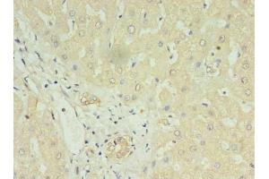 Immunohistochemistry of paraffin-embedded human liver tissue using ABIN7158666 at dilution of 1:100 (LYRM1 Antikörper  (AA 1-122))