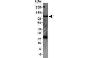 Western blot analysis of WNK4 in mouse kidney lysate with WNK4 polyclonal antibody . (WNK4 Antikörper  (AA 200-300))