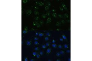 Immunofluorescence analysis of C6 cells using COPG2 Polyclonal Antibody (ABIN7266425) at dilution of 1:100 (40x lens). (COPG2 Antikörper  (AA 542-871))