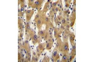 Immunohistochemistry analysis in formalin fixed and paraffin embedded human liver tissue reacted with PAGE5 Antibody (C-term) followed which was peroxidase conjugated to the secondary antibody and followed by DAB staining. (PAGE5 Antikörper  (C-Term))