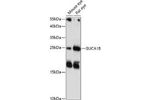 Western blot analysis of extracts of various cell lines, using GUCB antibody (4739) at 1:1000 dilution. (GUCA1B Antikörper  (AA 1-200))