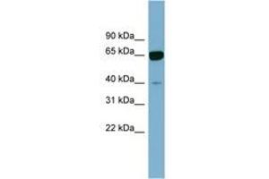 Image no. 1 for anti-Zinc Finger Protein 169 (ZNF169) (AA 71-120) antibody (ABIN6742078) (ZNF169 Antikörper  (AA 71-120))