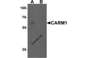 Western Blotting (WB) image for anti-Coactivator-Associated Arginine Methyltransferase 1 (CARM1) (N-Term) antibody (ABIN1077435) (CARM1 Antikörper  (N-Term))