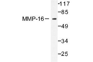 Image no. 1 for anti-Matrix Metallopeptidase 16 (Membrane-inserted) (MMP16) antibody (ABIN265527) (MMP16 Antikörper)