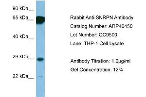 WB Suggested Anti-SNRPN Antibody   Titration: 1. (SNRPN Antikörper  (N-Term))