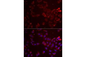 Immunofluorescence analysis of A549 cells using GATM antibody (ABIN5973965). (GATM Antikörper)