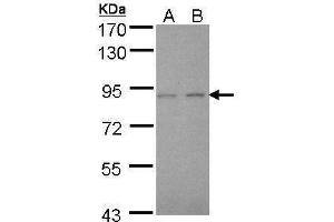 WB Image Sample (30 ug of whole cell lysate) A: A431 , B: H1299 7. (LIMK2 Antikörper)