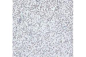 IHC analysis of PTBP2 using anti-PTBP2 antibody (ABIN7599452).