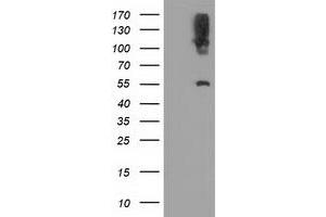 Western Blotting (WB) image for anti-Lipase, Endothelial (LIPG) antibody (ABIN1499173) (LIPG Antikörper)