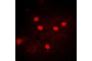 Immunofluorescent analysis of USP26 staining in A549 cells.