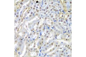 Immunohistochemistry of paraffin-embedded mouse kidney using TUSC2 antibody (ABIN5974256) at dilution of 1/200 (40x lens). (TUSC2 Antikörper)