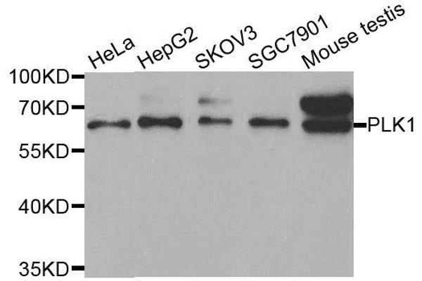 PLK1 antibody  (AA 304-603)