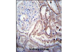 SCDGFB Antibody (Center) (ABIN390196 and ABIN2840684) immunohistochemistry analysis in formalin fixed and paraffin embedded human kidney tissue followed by peroxidase conjugation of the secondary antibody and DAB staining. (PDGFD Antikörper  (AA 313-341))