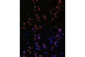 Immunofluorescence analysis of Jurkat cells using CD27 antibody (ABIN3022680, ABIN3022681, ABIN3022682 and ABIN6219092) at dilution of 1:100. (CD27 Antikörper  (AA 20-191))