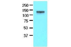 Western Blotting (WB) image for anti-EPH Receptor A2 (EPHA2) (AA 559-976) antibody (ABIN317512) (EPH Receptor A2 Antikörper  (AA 559-976))