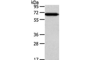 Western Blot analysis of Hepg2 cell using USP39 Polyclonal Antibody at dilution of 1/400 (USP39 Antikörper)