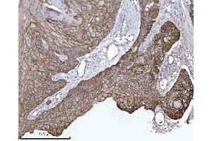 IHC analysis of CTNND1 using anti-CTNND1 antibody (ABIN7602220). (CTNND1 Antikörper  (AA 64-930))