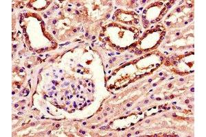 Immunohistochemistry of paraffin-embedded human kidney tissue using ABIN7143254 at dilution of 1:100 (Acylglycerol Kinase Antikörper  (AA 32-65))