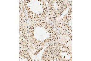 (ABIN6243447 and ABIN6578904) staining METTL14 in human testis tissue sections by Immunohistochemistry (IHC-P - paraformaldehyde-fixed, paraffin-embedded sections). (METTL14 Antikörper  (AA 2-36))