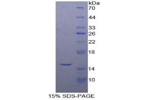 SDS-PAGE analysis of Human Inhibin beta A Protein. (INHBA Protein)