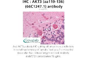 Image no. 1 for anti-V-Akt Murine Thymoma Viral Oncogene Homolog 3 (Protein Kinase B, Gamma) (AKT3) (AA 119-136) antibody (ABIN1723080)
