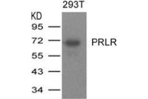 Western blot analysis of extracts from 293T cells expressing human PRLR protein using PRLR. (Prolactin Receptor Antikörper  (AA 25-29))