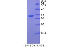 SDS-PAGE analysis of Rat ETFa Protein. (Electron-Transfer-Flavoprotein, alpha Polypeptide (ETFA) Peptid)