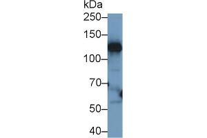 Western blot analysis of Human Liver lysate, using Human CP Antibody (1 µg/ml) and HRP-conjugated Goat Anti-Rabbit antibody ( (Ceruloplasmin Antikörper  (AA 789-1065))