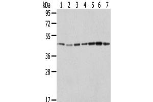 Western Blot analysis of Raji, A549, Hela, HepG2, 231, K562 and A431 cells using ERP44 Polyclonal Antibody at dilution of 1/200 (ERP44 Antikörper)