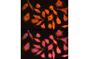 Immunofluorescence analysis of Mouse L929 cells using CK antibody (ABIN6127628, ABIN6138647, ABIN6138648 and ABIN6224627) at dilution of 1:100. (CKAP5 Antikörper  (AA 1763-2032))
