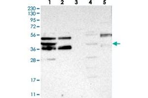 Western blot analysis of Lane 1: RT-4, Lane 2: U-251 MG, Lane 3: Human Plasma, Lane 4: Liver, Lane 5: Tonsil with FEZ2 polyclonal antibody  at 1:250-1:500 dilution. (FEZ2 Antikörper)