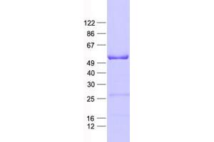 Western Blotting (WB) image for BTB (POZ) Domain Containing 3 (BTBD3) protein (His tag) (ABIN2716725)