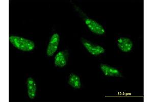 Immunofluorescence of purified MaxPab antibody to SNIP1 on HeLa cell. (SNIP1 Antikörper  (AA 1-396))