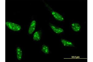 Immunofluorescence of purified MaxPab antibody to SNIP1 on HeLa cell.