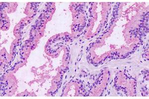 Anti-GPRC5A / RAI3 antibody IHC staining of human prostate. (GPRC5A Antikörper  (Extracellular Domain))